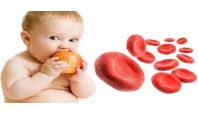 ارتباط کم خونی ناشی از کمبود آهن با کمبود فولیک اسید و ویتامین B12 در کودکان 