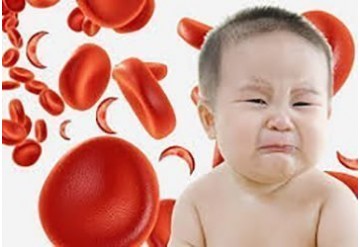 تاثیر مکمل های ویتامین A بر روی فرایند خونسازی در کودکان مبتلا به کم خونی