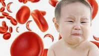 تاثیر مکمل های آهن بر سطح سرب در کودکان مبتلا به کم خونی