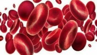 مدیریت بالینی کم خونی ناشی از کمبود آهن: پیشرفت های جدید در تشخیص و درمان آن