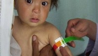 مطالعه کمبود ریزمغذی ها در کودکانی که دچار سوء تغذیه هستند